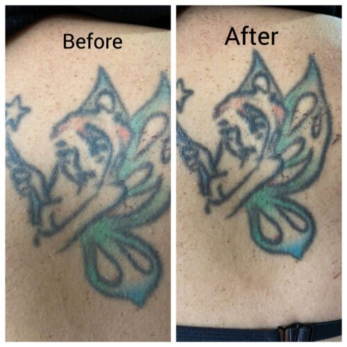 Tattoo Aftercare - For New Tattoos photo review